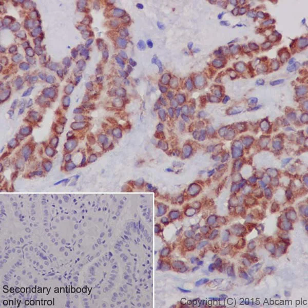 Immunohistochemistry (Formalin/PFA-fixed paraffin-embedded sections) - Anti-MTCO1 antibody [EPR19628] (AB203912)