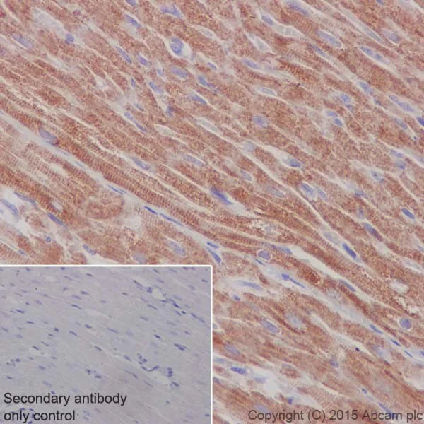 Immunohistochemistry (Formalin/PFA-fixed paraffin-embedded sections) - Anti-MTCO1 antibody [EPR19628] (AB203912)