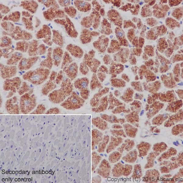 Immunohistochemistry (Formalin/PFA-fixed paraffin-embedded sections) - Anti-MTCO1 antibody [EPR19628] (AB203912), expandable thumbnail