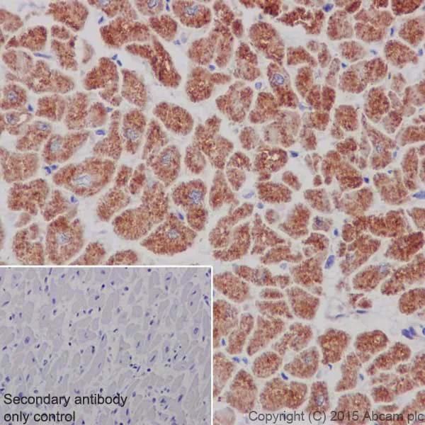 Immunohistochemistry (Formalin/PFA-fixed paraffin-embedded sections) - Anti-MTCO1 antibody [EPR19628] (AB203912)