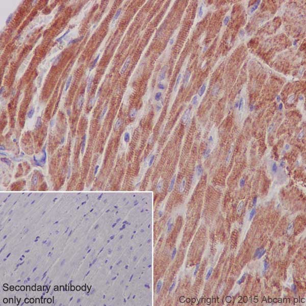 Immunohistochemistry (Formalin/PFA-fixed paraffin-embedded sections) - Anti-MTCO1 antibody [EPR19628] (ab203912), expandable thumbnail