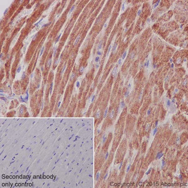 Immunohistochemistry (Formalin/PFA-fixed paraffin-embedded sections) - Anti-MTCO1 antibody [EPR19628] (AB203912)