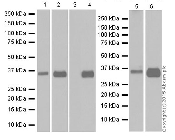 Western blot - Anti-MTCO1 antibody [EPR19628] (AB203912), expandable thumbnail