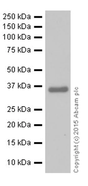 Western blot - Anti-MTCO1 antibody [EPR19628] (AB203912)