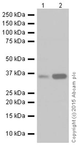 Western blot - Anti-MTCO1 antibody [EPR19628] (AB203912)