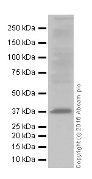 Western blot - Anti-MTCO1 antibody [EPR19642] (AB203917)