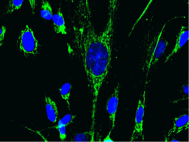 Immunocytochemistry/ Immunofluorescence - Anti-MTCO2 antibody [12C4F12] (AB110258), expandable thumbnail