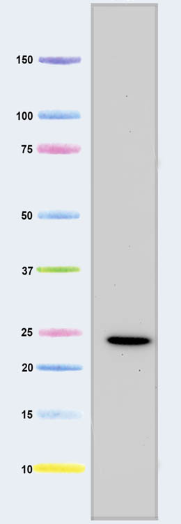Western blot - Anti-MTCO2 antibody [12C4F12] (AB110258), expandable thumbnail