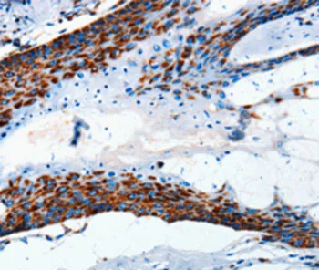 Immunohistochemistry (Formalin/PFA-fixed paraffin-embedded sections) - Anti-MTCO2 antibody (AB198286)