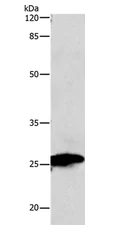 Western blot - Anti-MTCO2 antibody (AB198286)