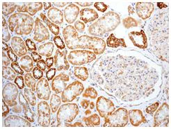 Immunohistochemistry (Formalin/PFA-fixed paraffin-embedded sections) - Anti-MTCO2 antibody [EPR3313] - BSA and Azide free (AB247921)