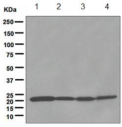 Western blot - Anti-MTCO2 antibody [EPR3313] - BSA and Azide free (AB247921), expandable thumbnail
