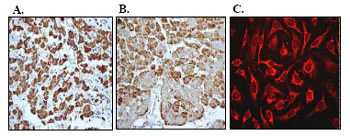 Immunohistochemistry (Formalin/PFA-fixed paraffin-embedded sections) - Anti-MTCO2 antibody [EPR3314] - BSA and Azide free (AB239889)