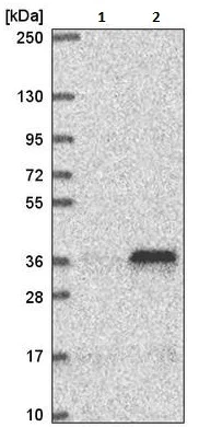 Western blot - Anti-MTERF antibody (AB221766)