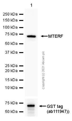 Western blot - Anti-MTERF antibody [EPR14202] (AB181836)