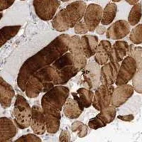 Immunohistochemistry (Formalin/PFA-fixed paraffin-embedded sections) - Anti-MTERFD2 antibody (AB121910)