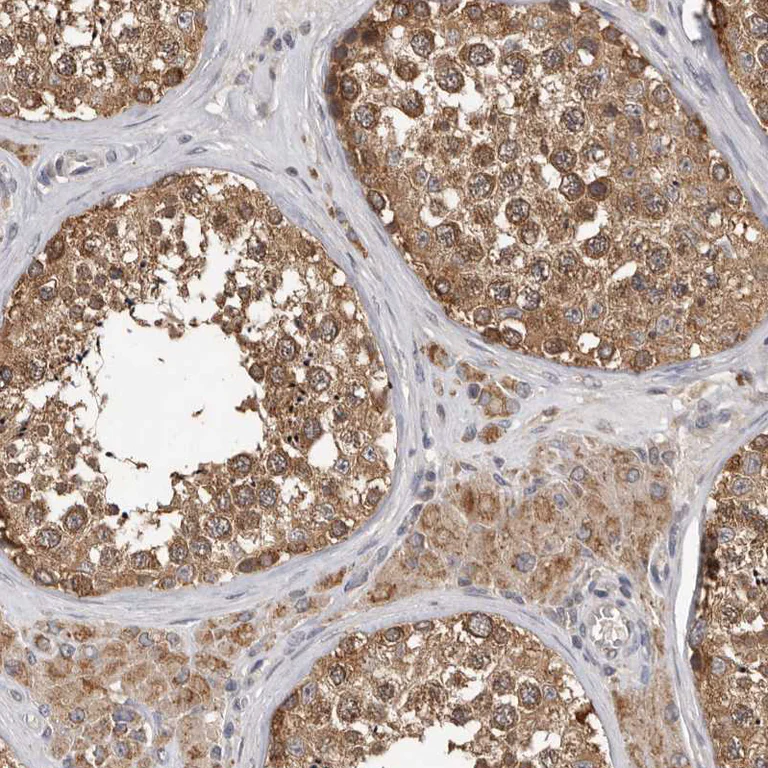 Immunohistochemistry (Formalin/PFA-fixed paraffin-embedded sections) - Anti-MTF1 Antibody (AB327213)