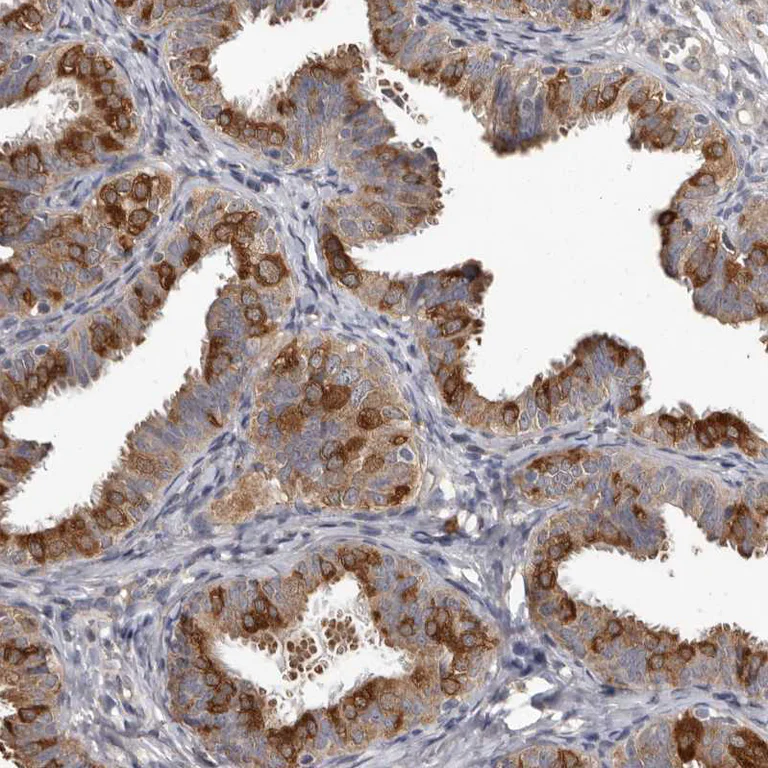 Immunohistochemistry (Formalin/PFA-fixed paraffin-embedded sections) - Anti-MTF1 Antibody (AB327213)