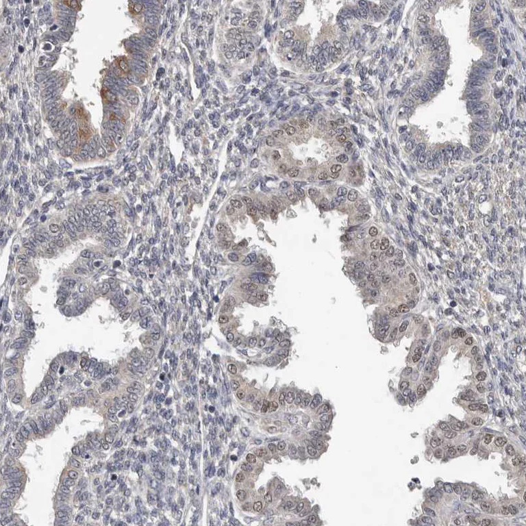Immunohistochemistry (Formalin/PFA-fixed paraffin-embedded sections) - Anti-MTF1 Antibody (AB327213)
