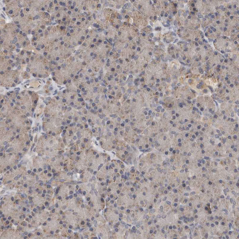 Immunohistochemistry (Formalin/PFA-fixed paraffin-embedded sections) - Anti-MTF1 Antibody (AB327213)