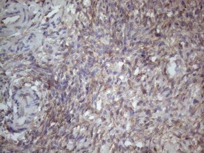 Immunohistochemistry (Formalin/PFA-fixed paraffin-embedded sections) - Anti-MTF1 antibody [OTI2F3] (AB236401)