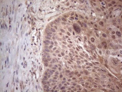 Immunohistochemistry (Formalin/PFA-fixed paraffin-embedded sections) - Anti-MTF1 antibody [OTI2F3] (AB236401)
