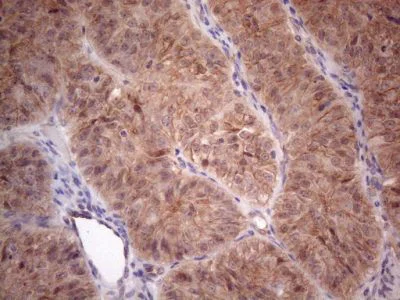 Immunohistochemistry (Formalin/PFA-fixed paraffin-embedded sections) - Anti-MTF1 antibody [OTI2F3] (AB236401)