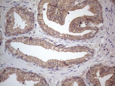 Immunohistochemistry (Formalin/PFA-fixed paraffin-embedded sections) - Anti-MTF1 antibody [OTI2F3] (AB236401)