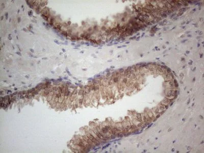 Immunohistochemistry (Formalin/PFA-fixed paraffin-embedded sections) - Anti-MTF1 antibody [OTI2F3] (AB236401)