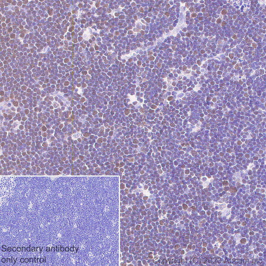Immunohistochemistry (Formalin/PFA-fixed paraffin-embedded sections) - Anti-MTF2 antibody [EPR27196-167] (ab314753), expandable thumbnail