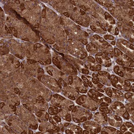 Immunohistochemistry (Formalin/PFA-fixed paraffin-embedded sections) - Anti-MTFMT/FMT antibody (AB243815)