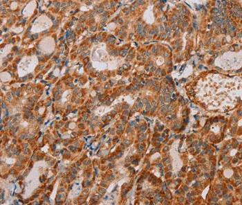 Immunohistochemistry (Formalin/PFA-fixed paraffin-embedded sections) - Anti-MTFR1 antibody (AB198192)