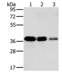 Western blot - Anti-MTFR1 antibody (AB198192)