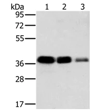 Western blot - Anti-MTFR1 antibody (AB198192)