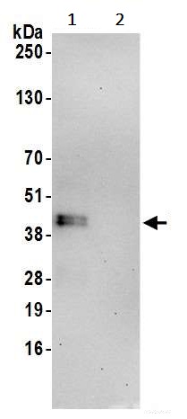 Immunoprecipitation - Anti-MTFR1 antibody (AB242093)