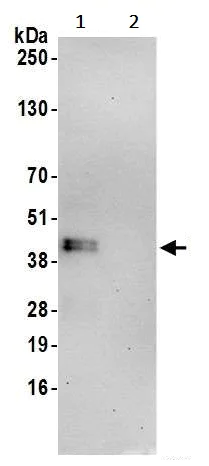 Immunoprecipitation - Anti-MTFR1 antibody (AB242093)