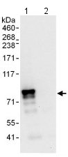 Immunoprecipitation - Anti-MTG16 antibody (AB129444)
