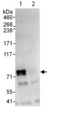 Immunoprecipitation - Anti-MTGR1 antibody (AB128164)