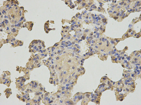 Immunohistochemistry (Formalin/PFA-fixed paraffin-embedded sections) - Anti-MTH1 antibody (AB187531)