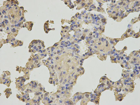 Immunohistochemistry (Formalin/PFA-fixed paraffin-embedded sections) - Anti-MTH1 antibody (AB187531)