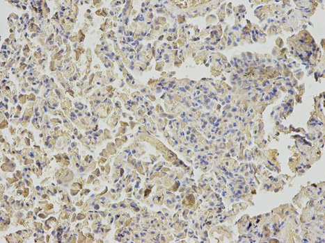 Immunohistochemistry (Formalin/PFA-fixed paraffin-embedded sections) - Anti-MTH1 antibody (AB187531)