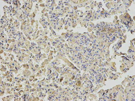 Immunohistochemistry (Formalin/PFA-fixed paraffin-embedded sections) - Anti-MTH1 antibody (AB187531)