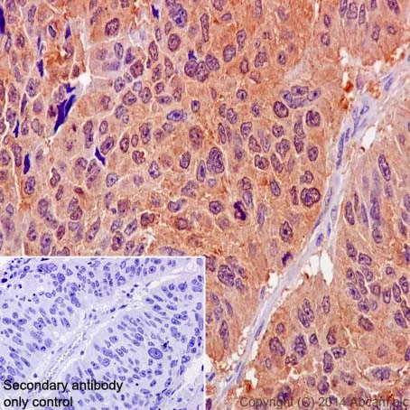 Immunohistochemistry (Formalin/PFA-fixed paraffin-embedded sections) - Anti-MTH1 antibody [EPR15934-50] (AB200832)