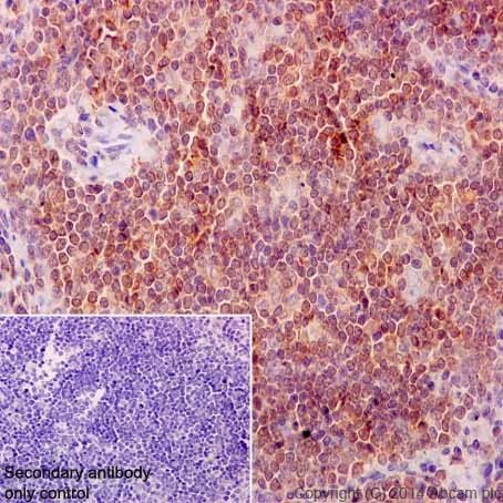 Immunohistochemistry (Formalin/PFA-fixed paraffin-embedded sections) - Anti-MTH1 antibody [EPR15934-50] (AB200832)