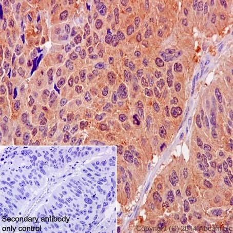 Immunohistochemistry (Formalin/PFA-fixed paraffin-embedded sections) - Anti-MTH1 antibody [EPR15934-50] - BSA and Azide free (ab246327), expandable thumbnail