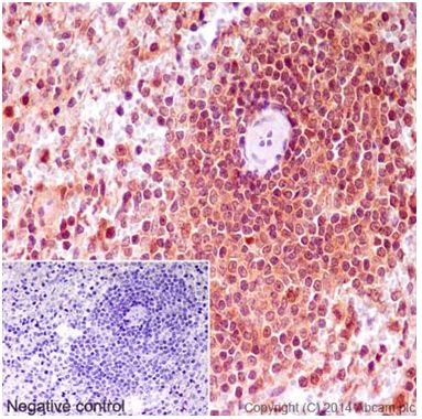 Immunohistochemistry (Formalin/PFA-fixed paraffin-embedded sections) - Anti-MTH1 antibody [EPR15934] (AB197028)