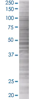 SDS-PAGE - MTH1 overexpression 293T lysate (whole cell) (AB94036)