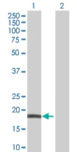 Western blot - MTH1 overexpression 293T lysate (whole cell) (AB94036)