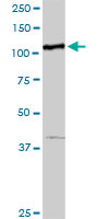 Western blot - Anti-MTHFD1 antibody (AB103698), expandable thumbnail