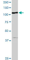 Western blot - Anti-MTHFD1 antibody (AB103698)